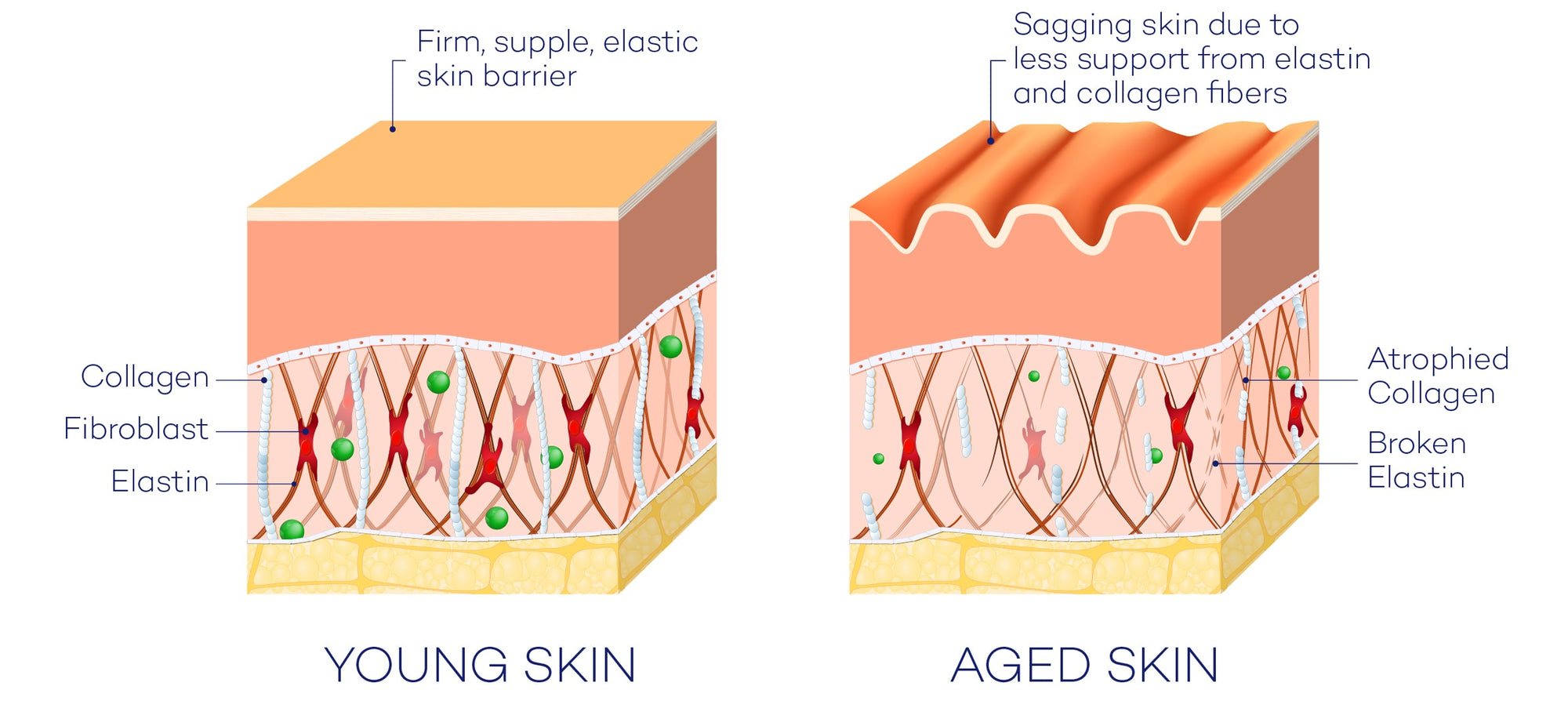 diagram displaying the difference between young and aged skin